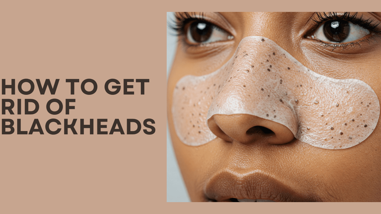 How to Get Rid of Blackheads: Expert Secrets Revealed for Healthy Skin 1 How to Get Rid of Blackheads
