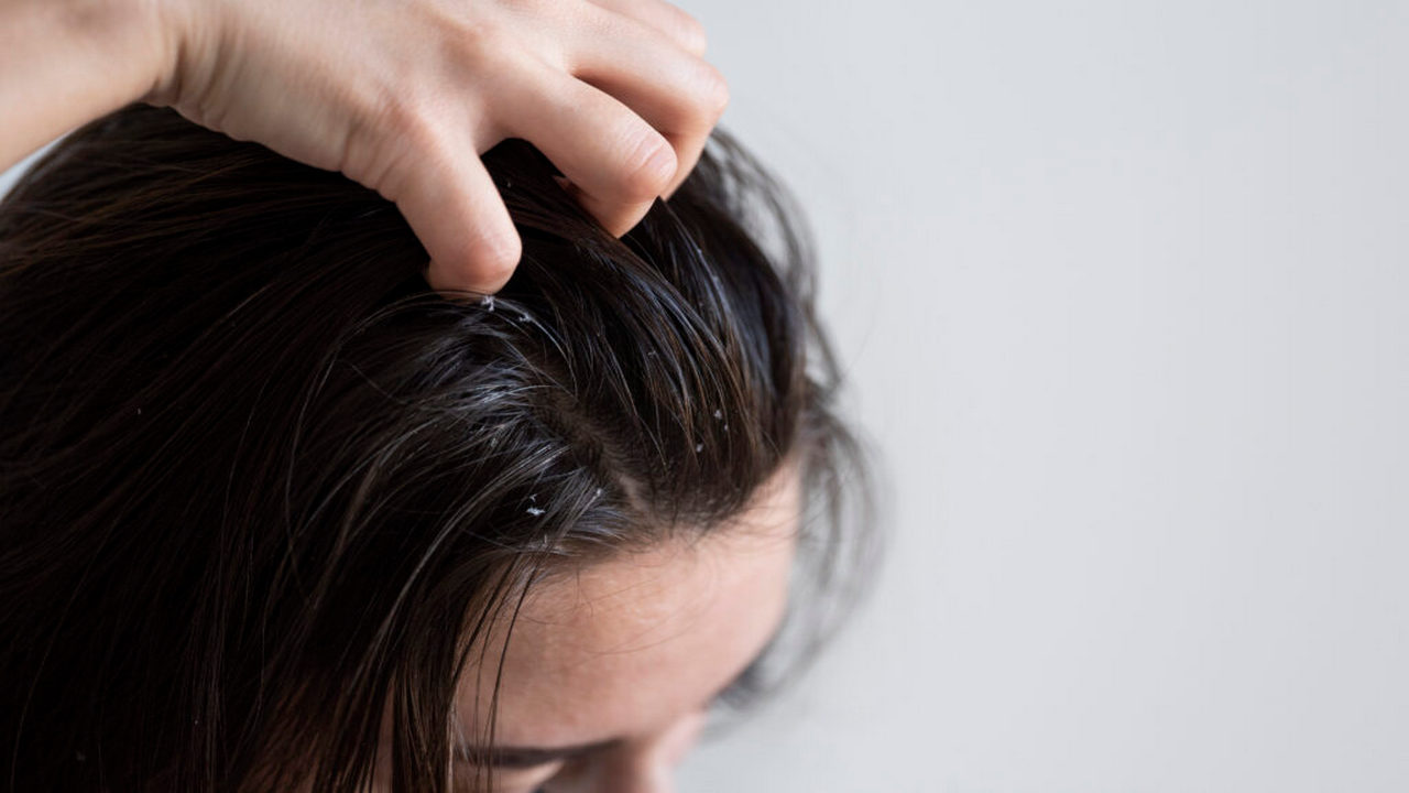 anti dandruff shampoo