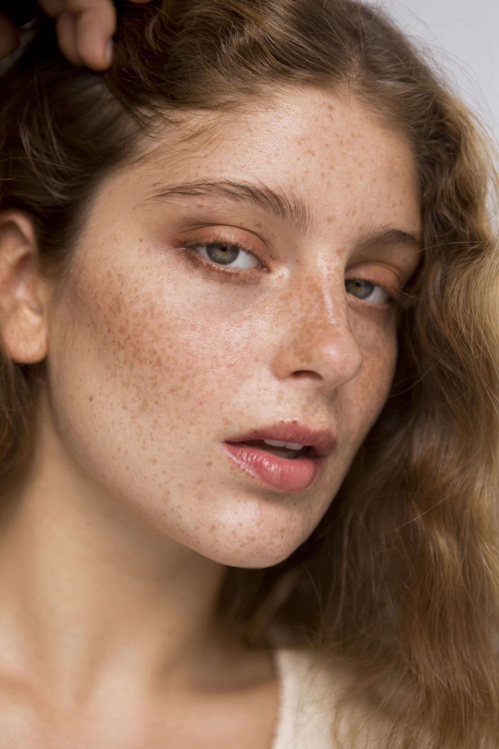 Hyperpigmentation on Face – Top 7 Proven Treatments to Fade Dark Spots Fast 1 Hyperpigmentation on Face