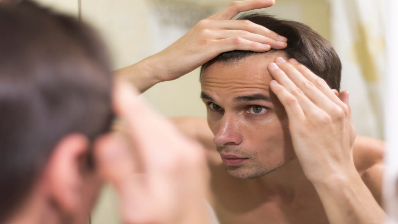 hair thinning