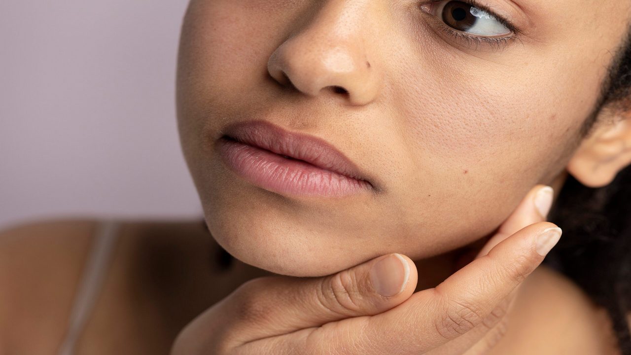 open pores