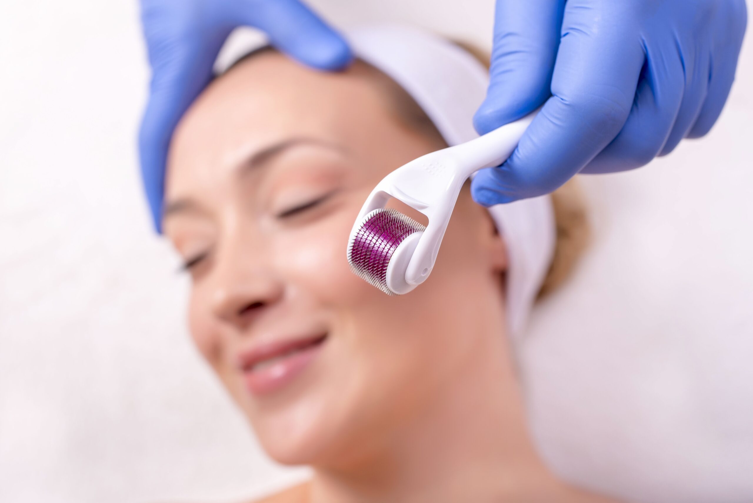 Derma Roller 2025: Easy Steps for Glowing Skin & Stronger Hair 1 How to Use a Derma Roller for Skin & Hair in 2025