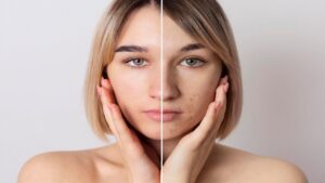 dark spots