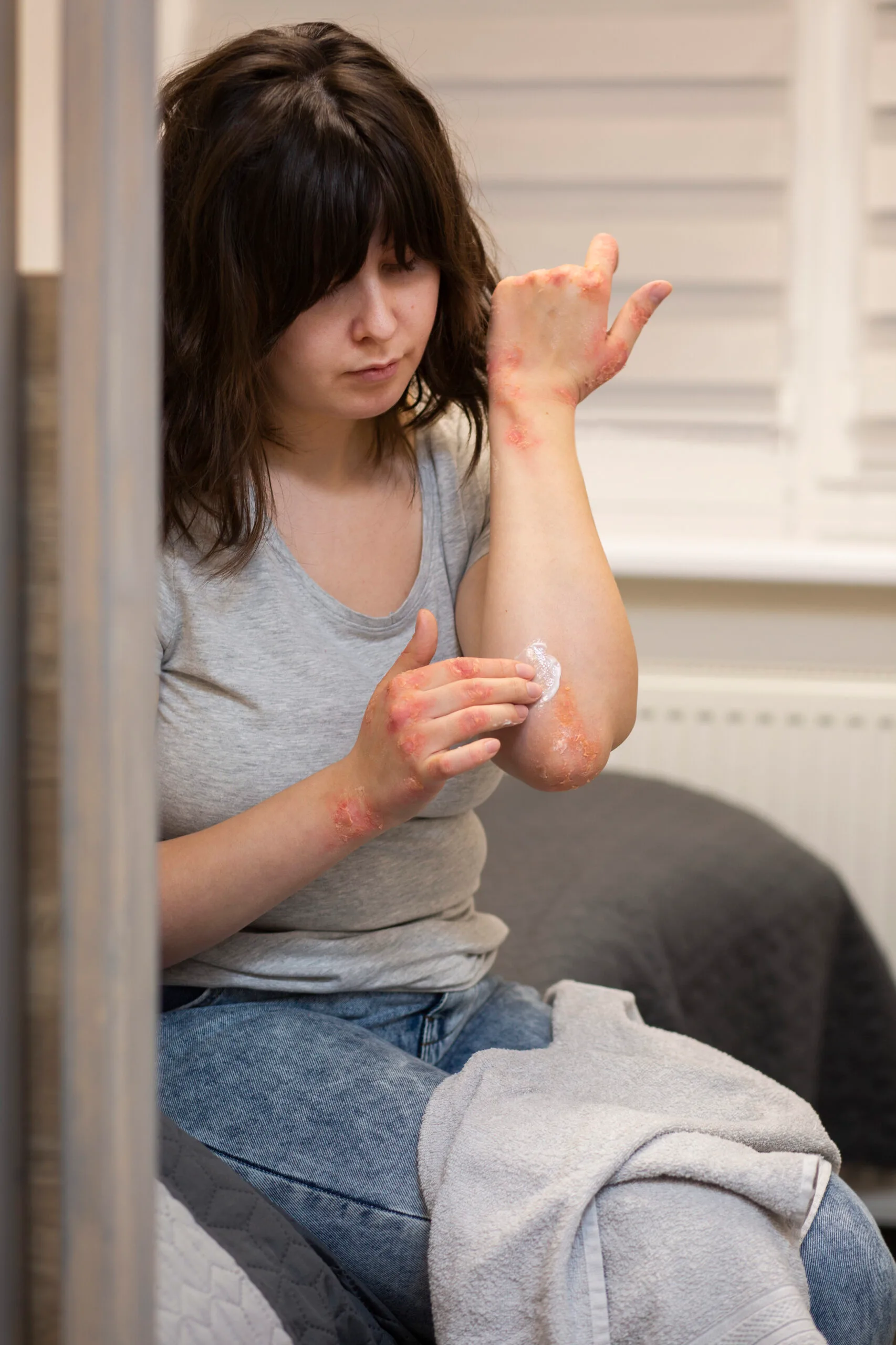 Home 42 Eczema Treatment Guide 2025: Complete Skin Care Tips