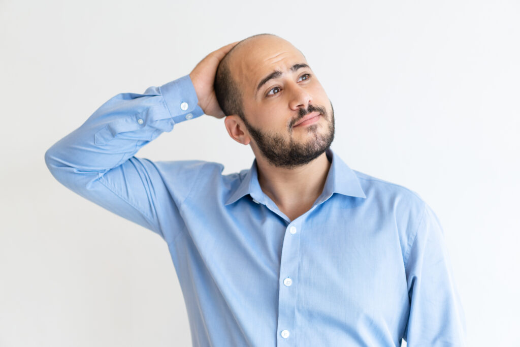 Alopecia Areata 2025: Breakthrough Treatments for Restoring Hair and Confidence 1 Alopecia Areata